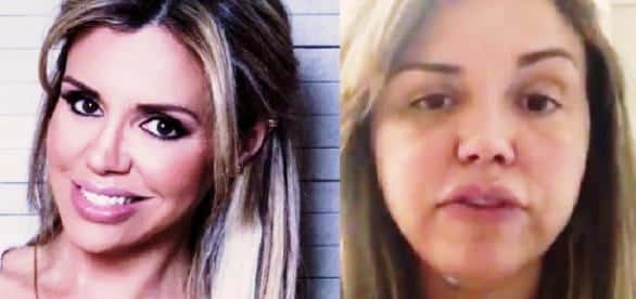 Renata Banhara ficou com o rosto inchado. (Foto: Reprodução)