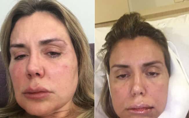 O atual estado de saúde de Renata Banhara. (Foto: Reprodução)