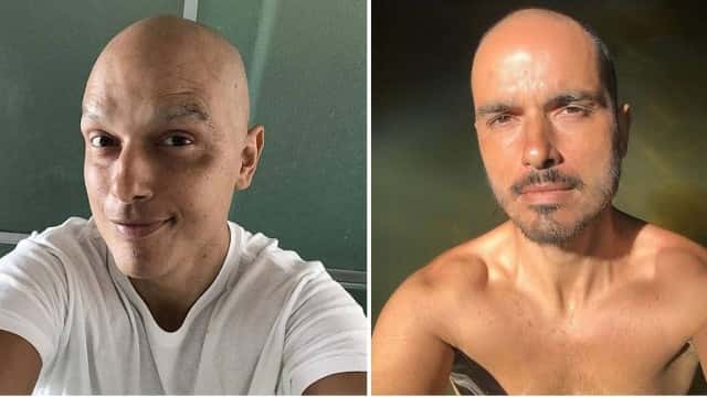 Antes e depois de Léo Rosa, ator da Record (Foto: Divulgação)