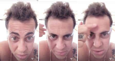 Thammy Miranda reclama de queda do cabelo. (Foto: Reprodução/Instagram)