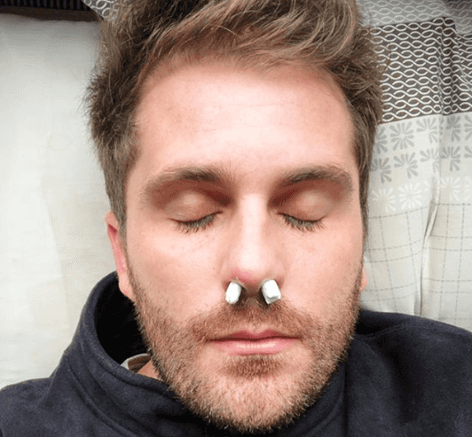 O ator Thiago Gagliasso apareceu com algodão no nariz e choca internet. (Foto: Reprodução)