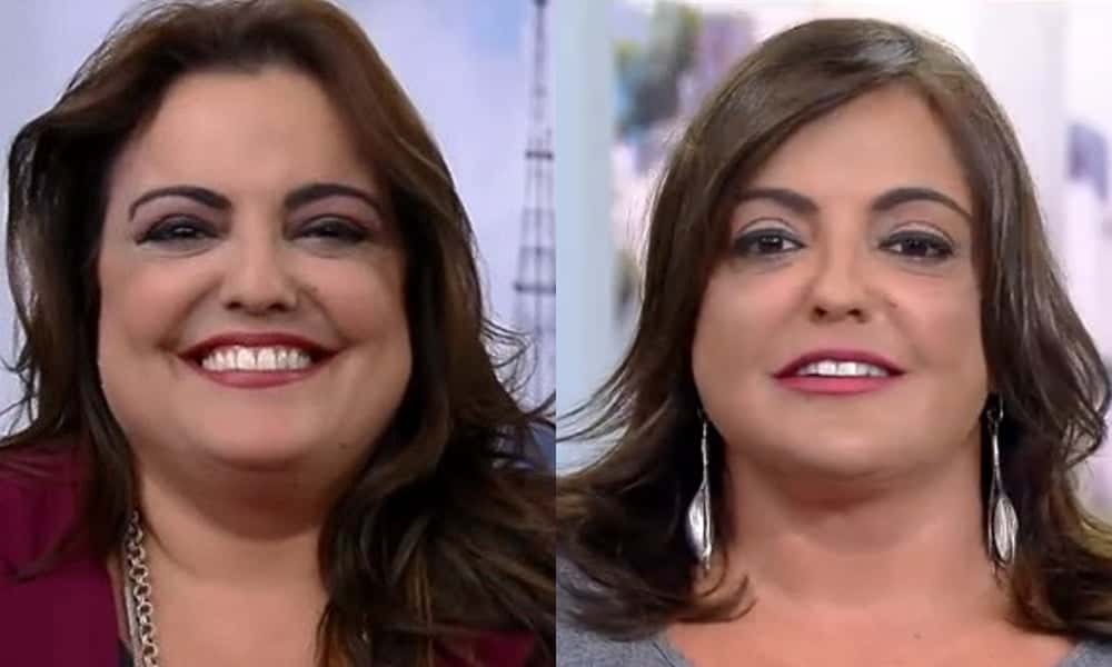 Fabíoal Reipert já passou por alguns procedimentos estéticos. (Foto: Reprodução/Montagem)