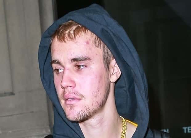 bieber1