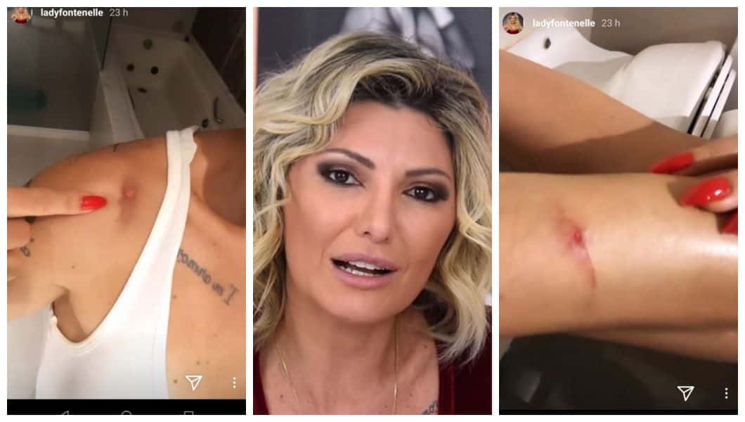 Antônia Fontenelle chamou a atenção do público por conta de machucados que adquiriu pós carnaval (Foto: Reprodução)