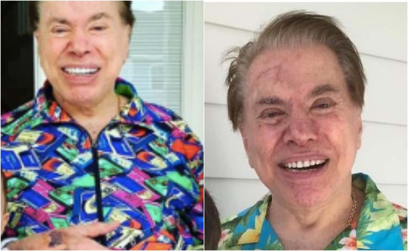 Aparência de Silvio preocupa (Foto: Reprodução)