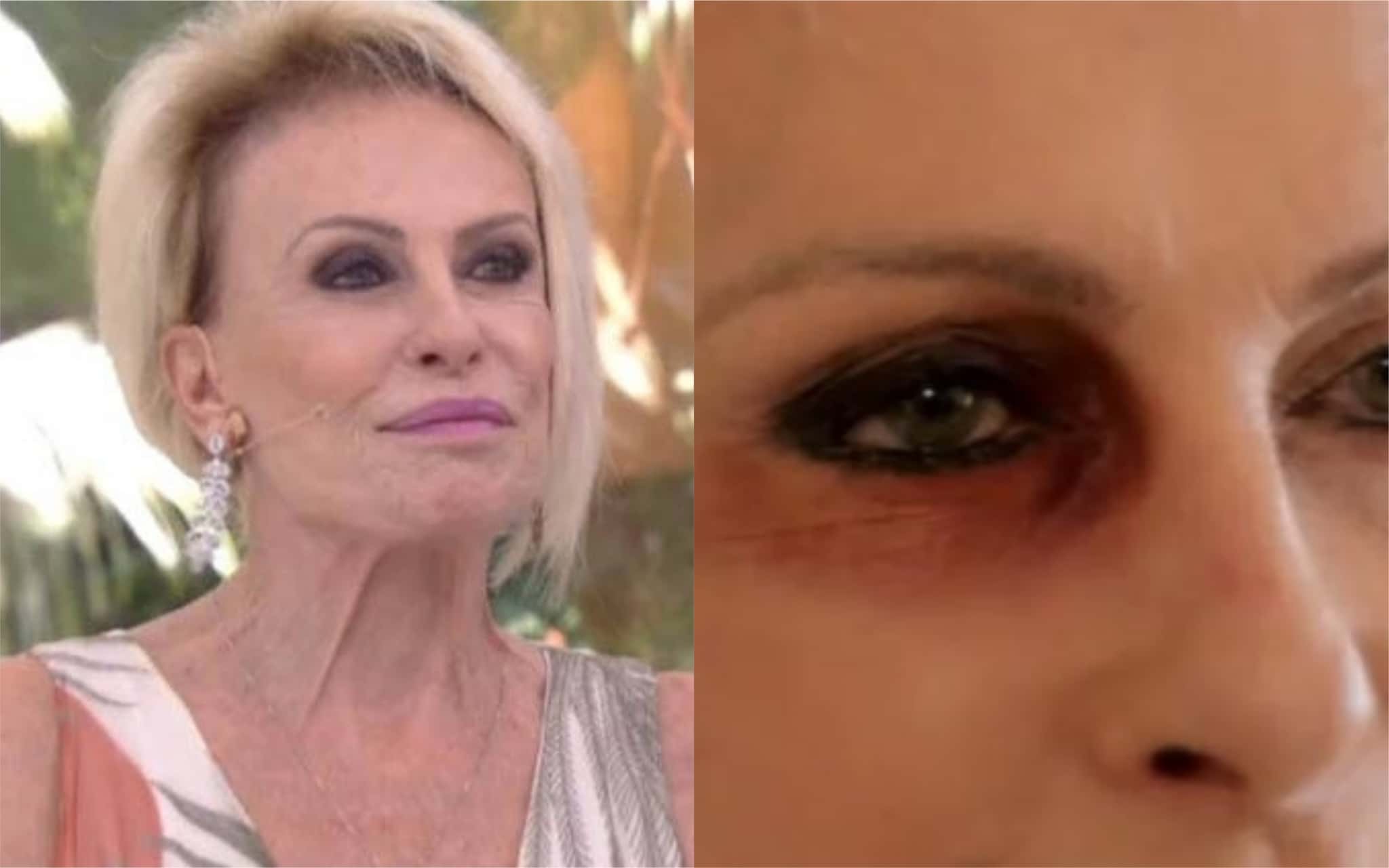 Ana Maria Braga (Foto: Montagem / TV Foco)