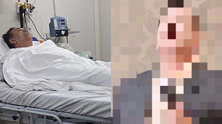 Famoso cantor Sandro Backer está necessitando fazer uma cirurgia no coração (Montagem: TV Foco)
