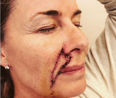 Apresentadora revela câncer de pele e preocupa (Foto: Reprodução)