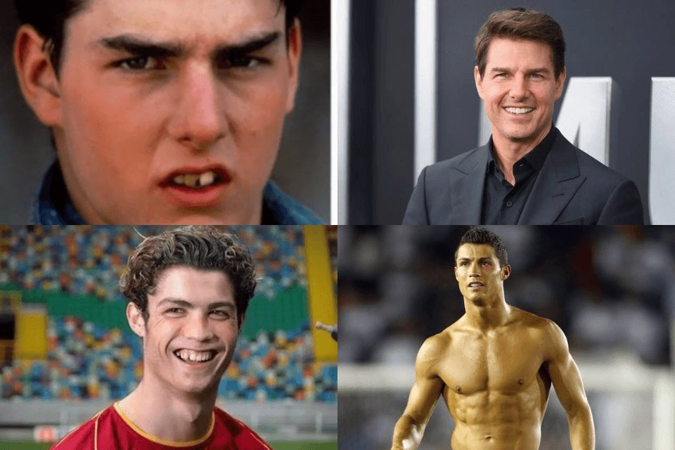 Surpreenda-se com o antes e depois de alguns famosos (Fotos: Reprodução)