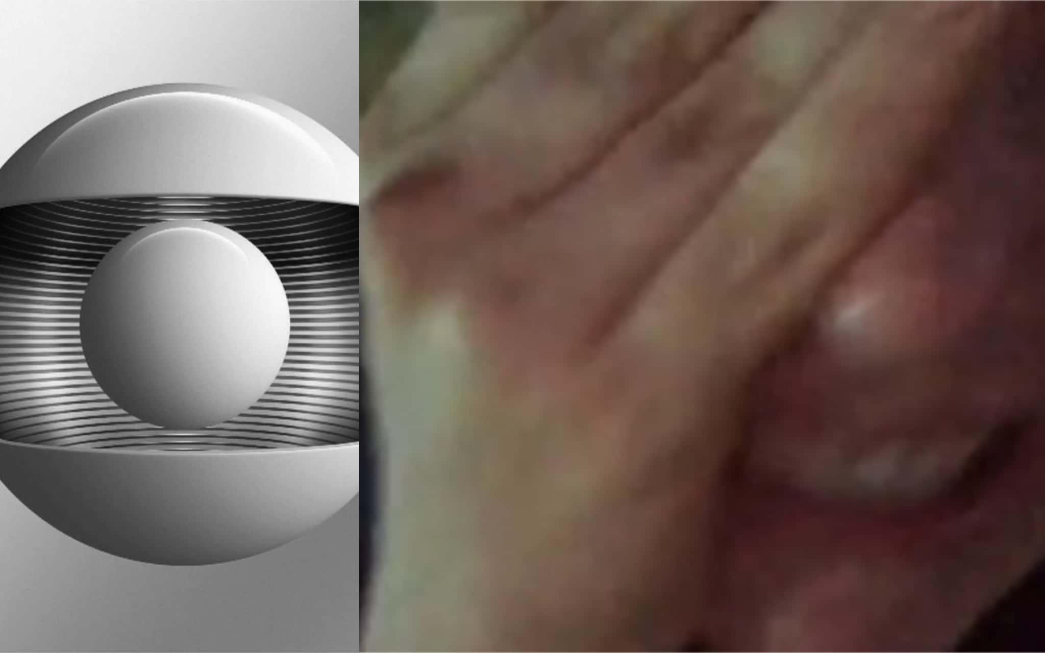 globo
