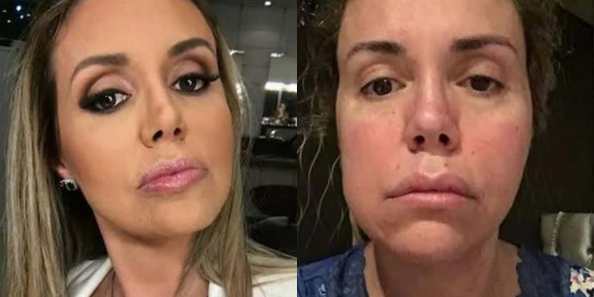 Renata Banhara desabafa sobre câncer incurável no cérebro (Foto: Reprodução)