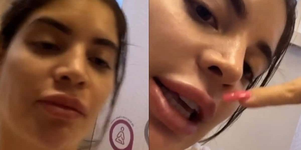 Gkay surgiu com corpo machucado nas redes sociais (Foto: reprodução)