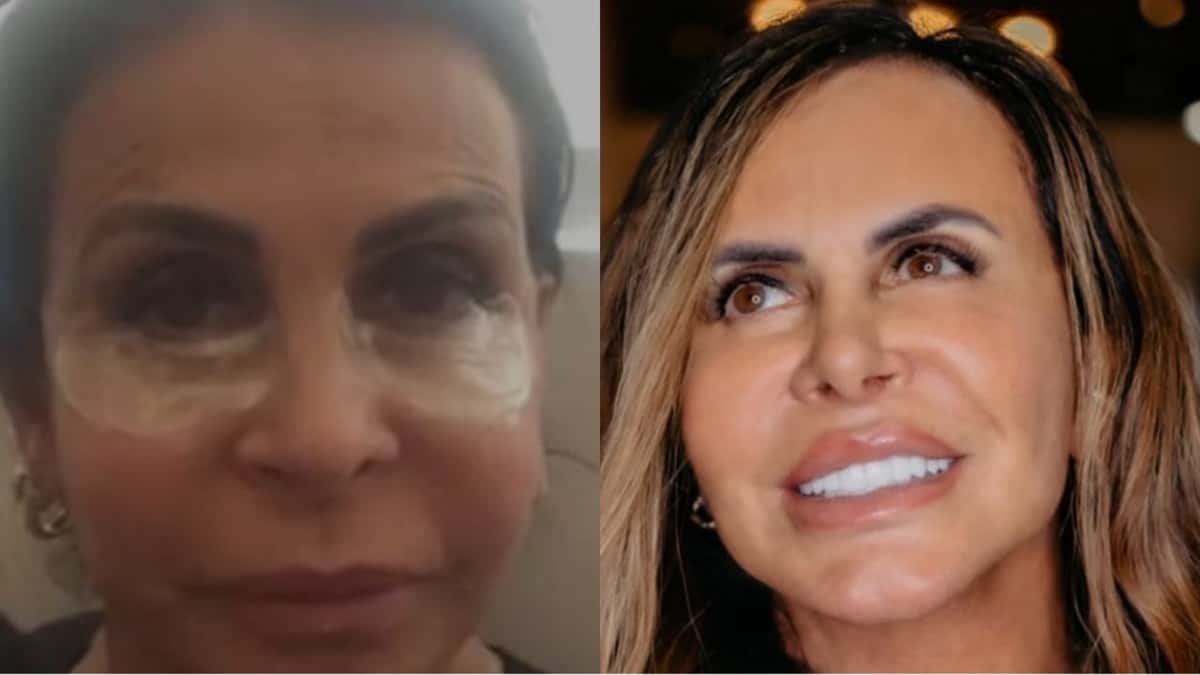Gretchen retira as olheiras dos olhos com tatuagem (Reprodução/ Instagram)