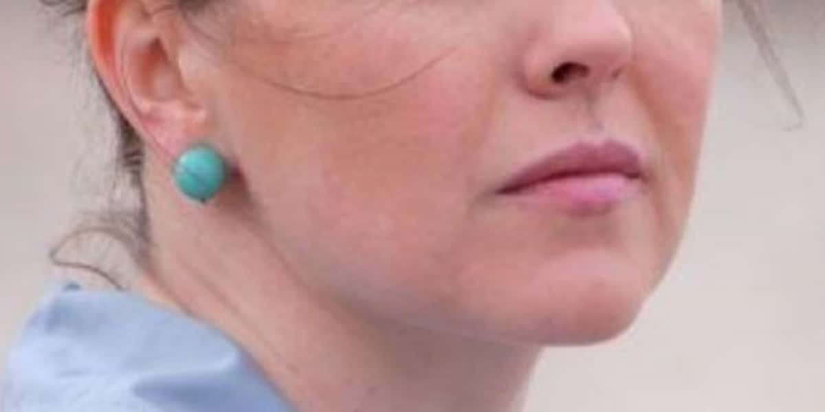 Atriz travava luta contra terrível câncer no cérebro (Foto: Reprodução)