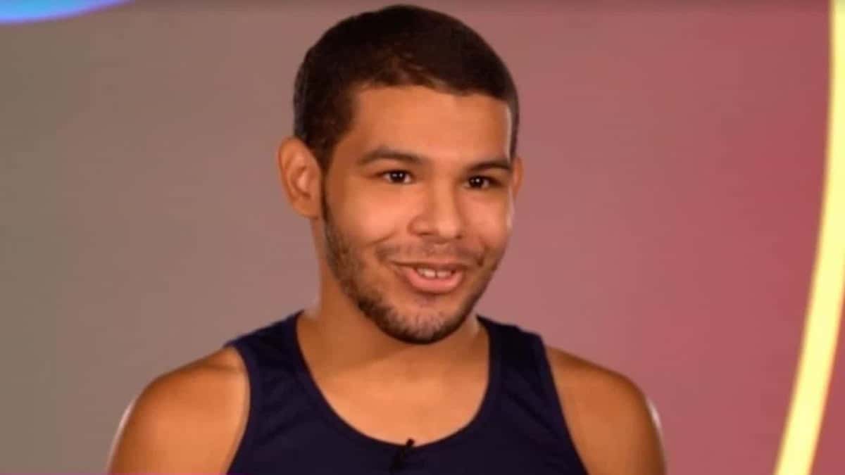 Vyni faz harmonização facial e surge irreconhecível (Foto: Reprodução)