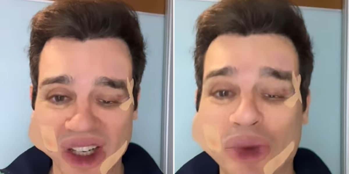 Celso Portiolli após "surra" (Montagem: TV Foco)