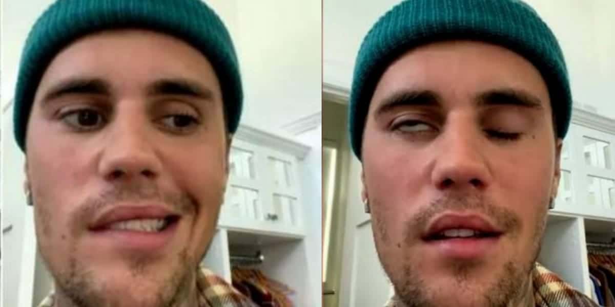 Justin Bieber recebeu diagnóstico de síndrome (Foto: Reprodução)