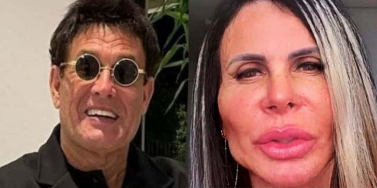Sérgio Mallandro faz harmonização facial e fãs reagem - Reprodução