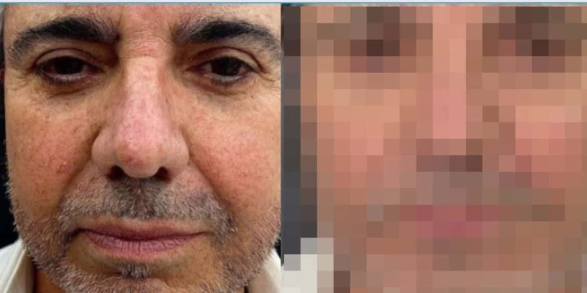 João Kleber passa por procedimento no rosto aos 65, muda tudo e resultado gera choque: "Foi feito" (Foto: Reprodução)