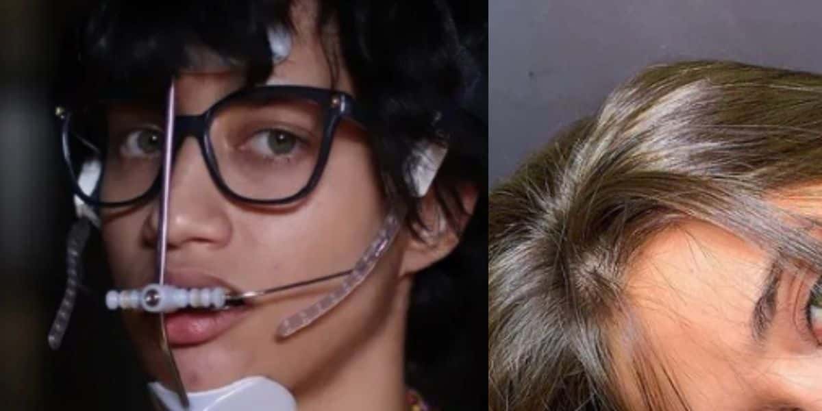 Atriz da Globo, que era cheia de aparelhos, hoje é uma das mulheres mais linda que você já viu (Foto: Reprodução)