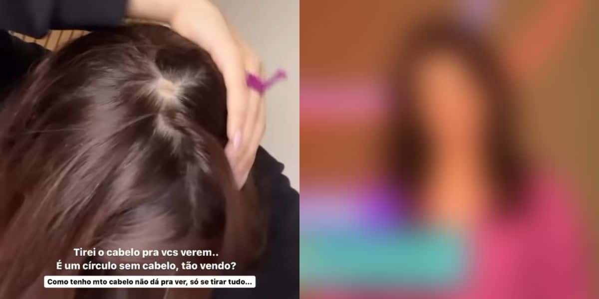 Eslovênia mostra o resultado da alopecia (Reprodução - Instagram)