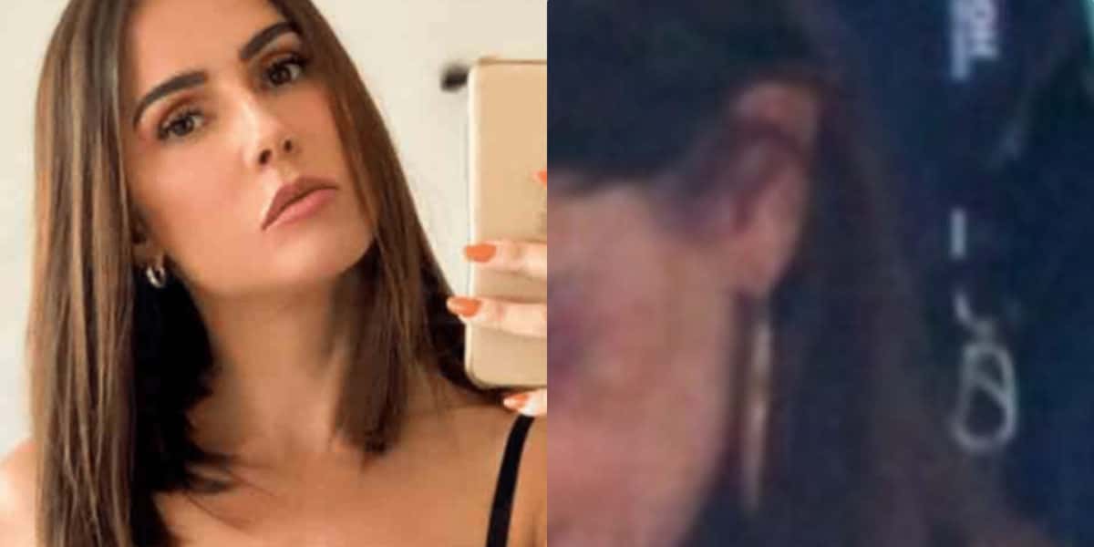Deborah Secco preocupa fãs ao aparecer toda machucada (Foto Reprodução/Montagem/Tv Foco)