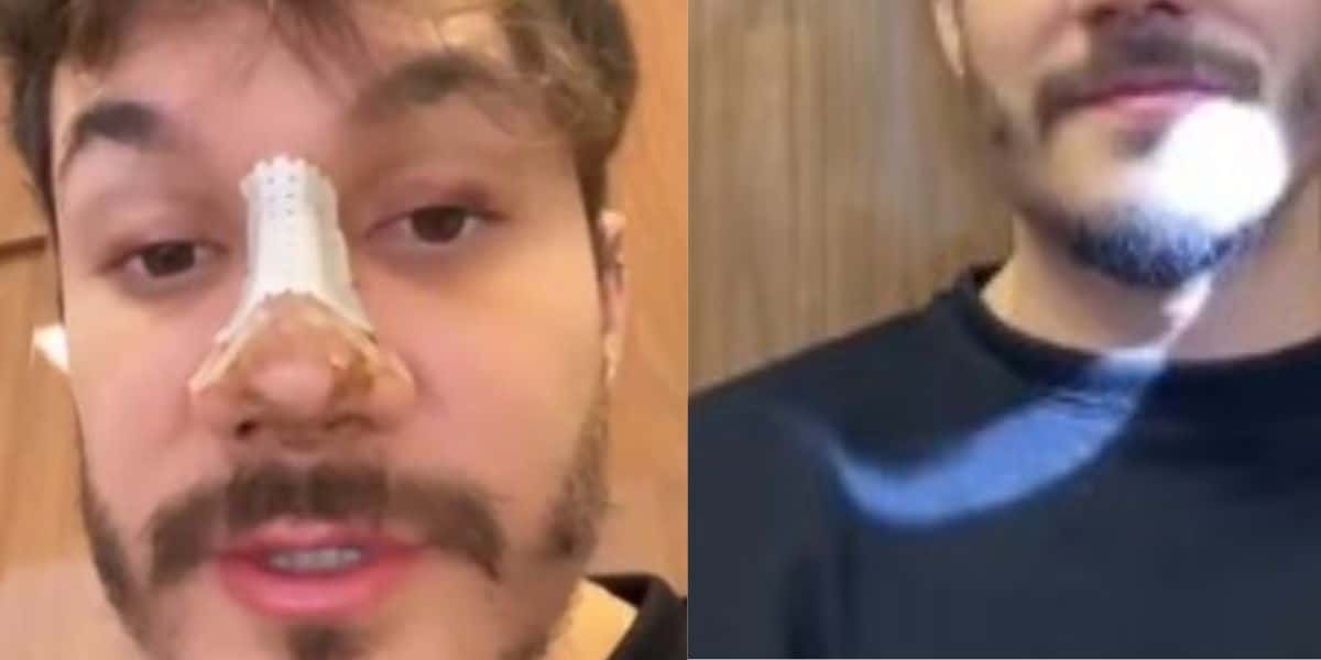 Eliezer passa por procedimento no rosto, tira curativos e entrega fotos do antes e depois - Foto: Reprodução Instagram
