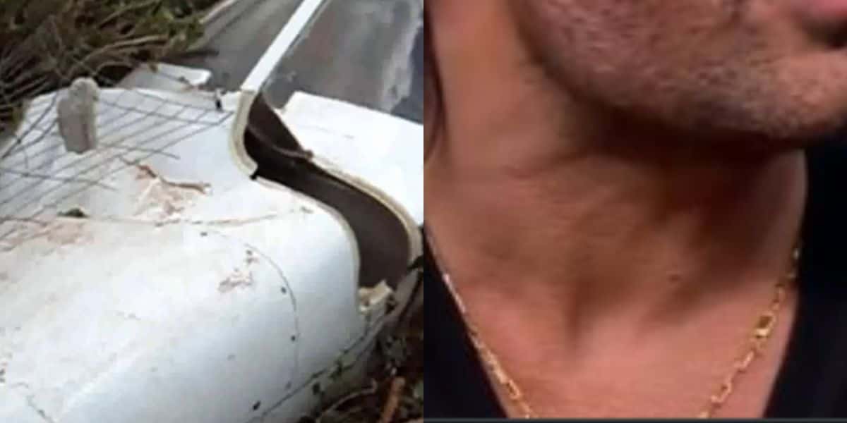 Cantor sertanejo sofreu queda de avião, teve rosto desfigurado e aparência até hoje é motivo de falatório (Foto: Reproduçao)