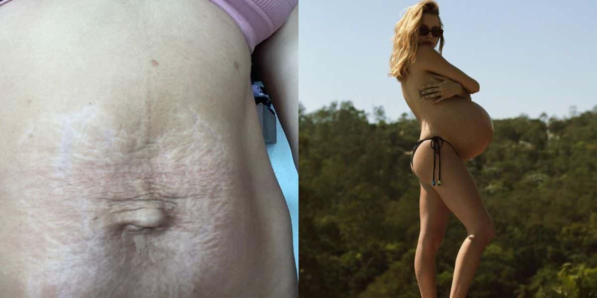 Isa Scherer mostra como ficou sua barriga após dar a luz (Reprodução - Instagram)