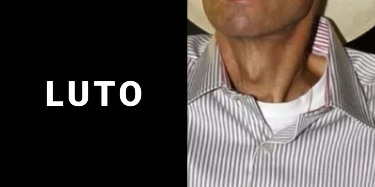Famoso cantor descobriu câncer terminal, ficou com a boca torta e impactou ao suplicar - Foto: Reprodução