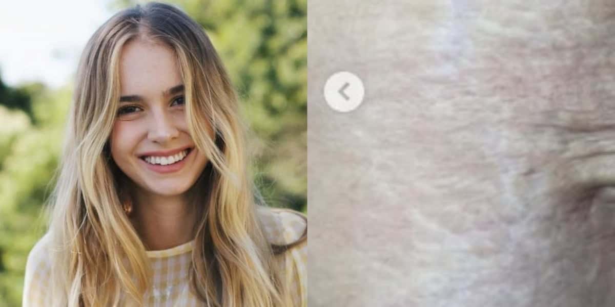 Isa Scherer mostra barriga real um mês após o parto dos gêmeos - Foto: Reprodução