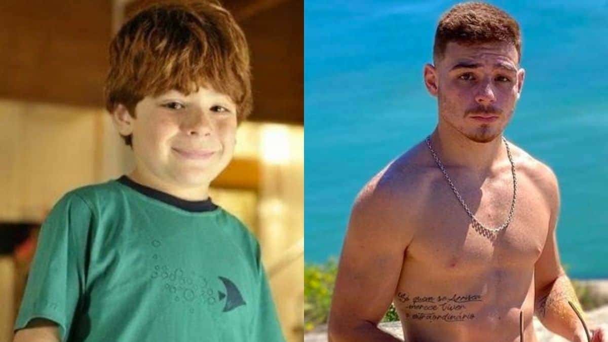 Ex-ator mirim de 'A Vida de Gente' renasceu após grave acidente: "112 pontos no rosto e perna quebrada" (Foto: Reprodução)