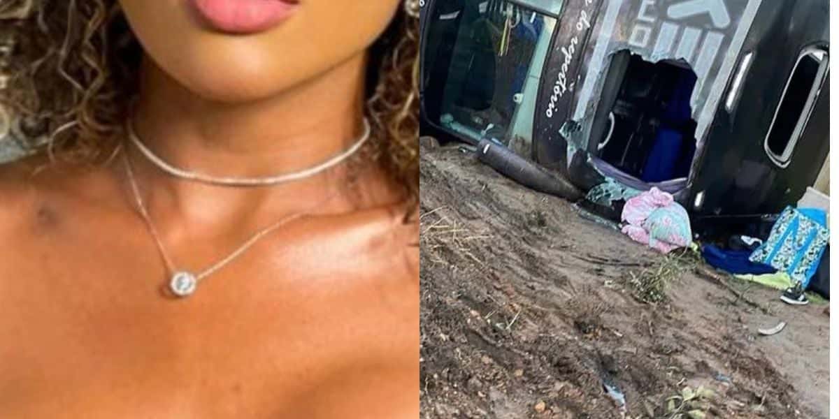 Famosa da Record sofre grave acidente, quebra cinco vértebras e faz triste relato após nascer de novo: "Dor" - Reprodução