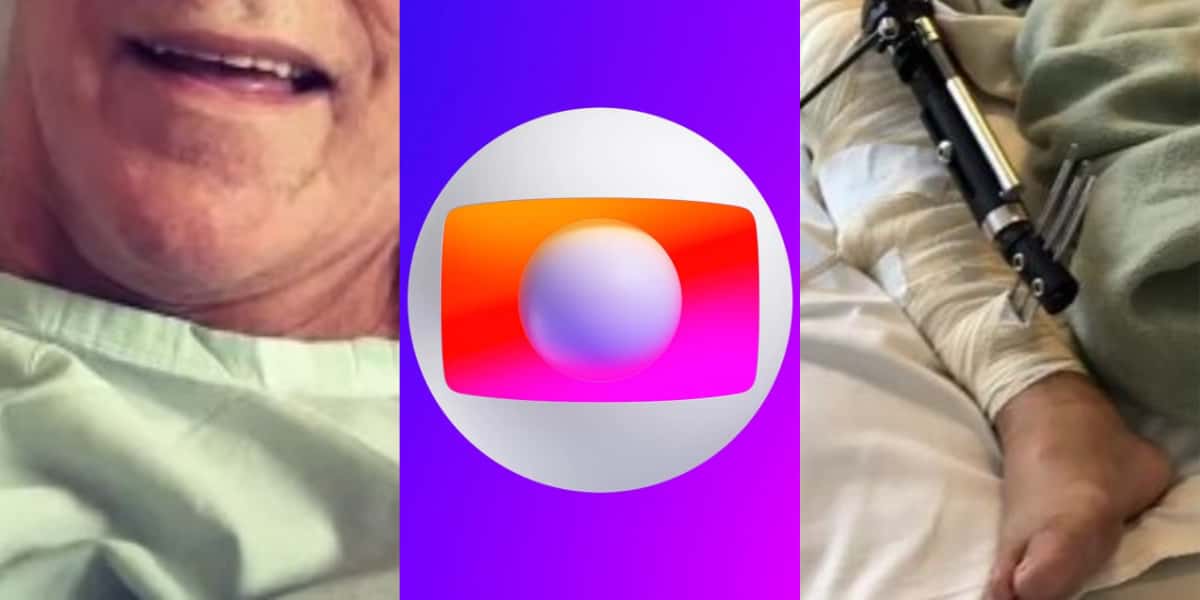 Galã da Globo sofreu grave acidente teve necrose e foi submetido a 65 cirurgias - Foto: Reprodução