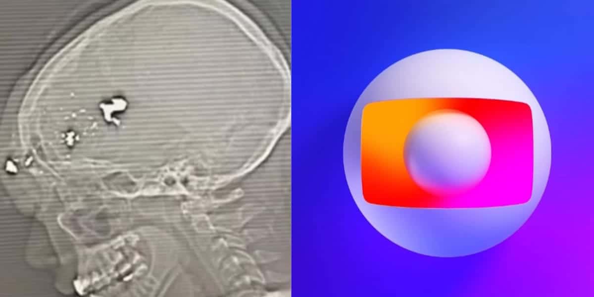 Globo confirma assalto de famoso e estado da saúde é divulgado (Reprodução: Montagem TV Foco)