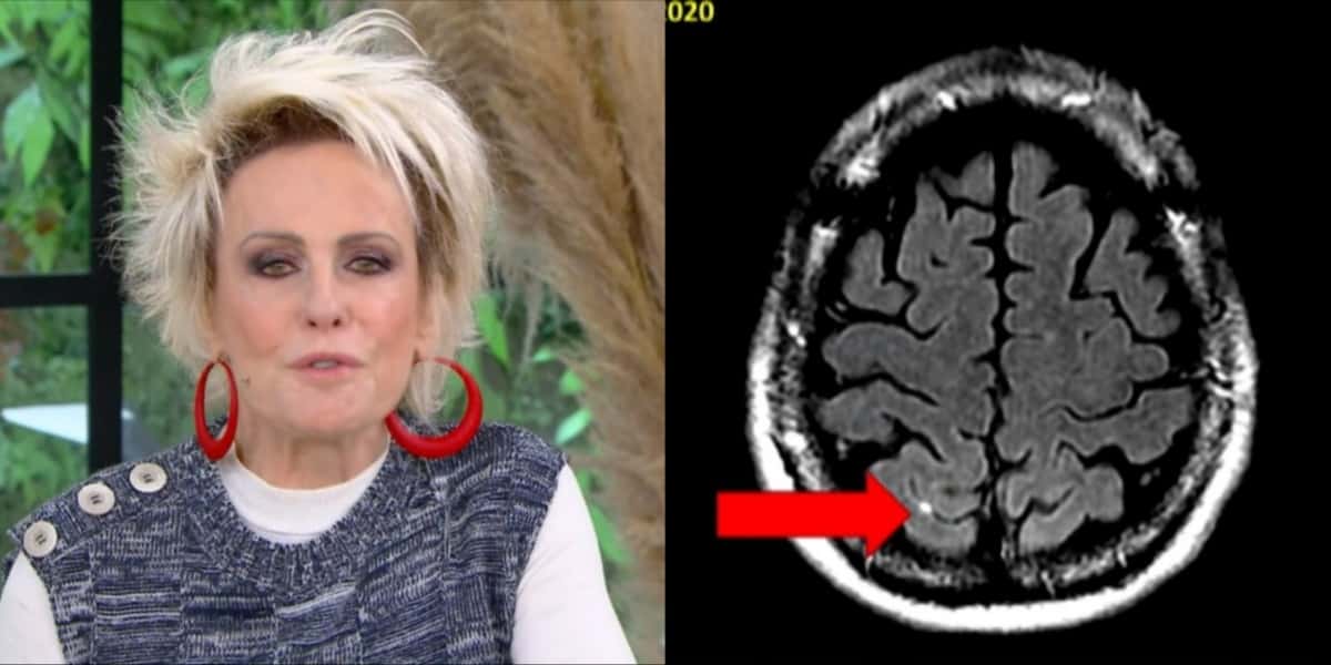 Ana Maria Braga mostrou detalhes de câncer no "Mais Você" (Foto: Reprodução/TV Globo)
