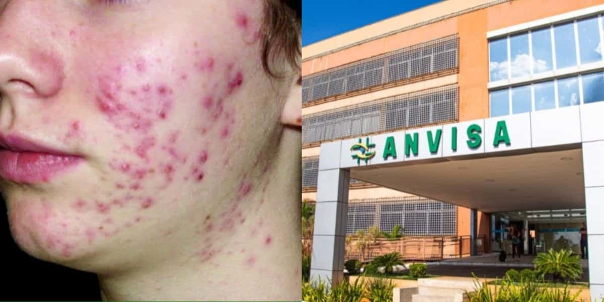 Anvisa baixa o facão e proibição em 5 produtos queridinhos - Foto: Montagem