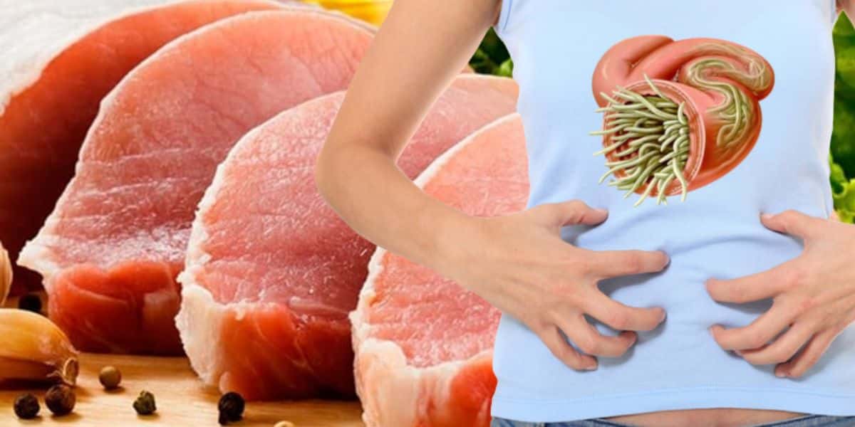 Carne muito amada com verme e doença fatal (Reprodução: Montagem TV Foco)