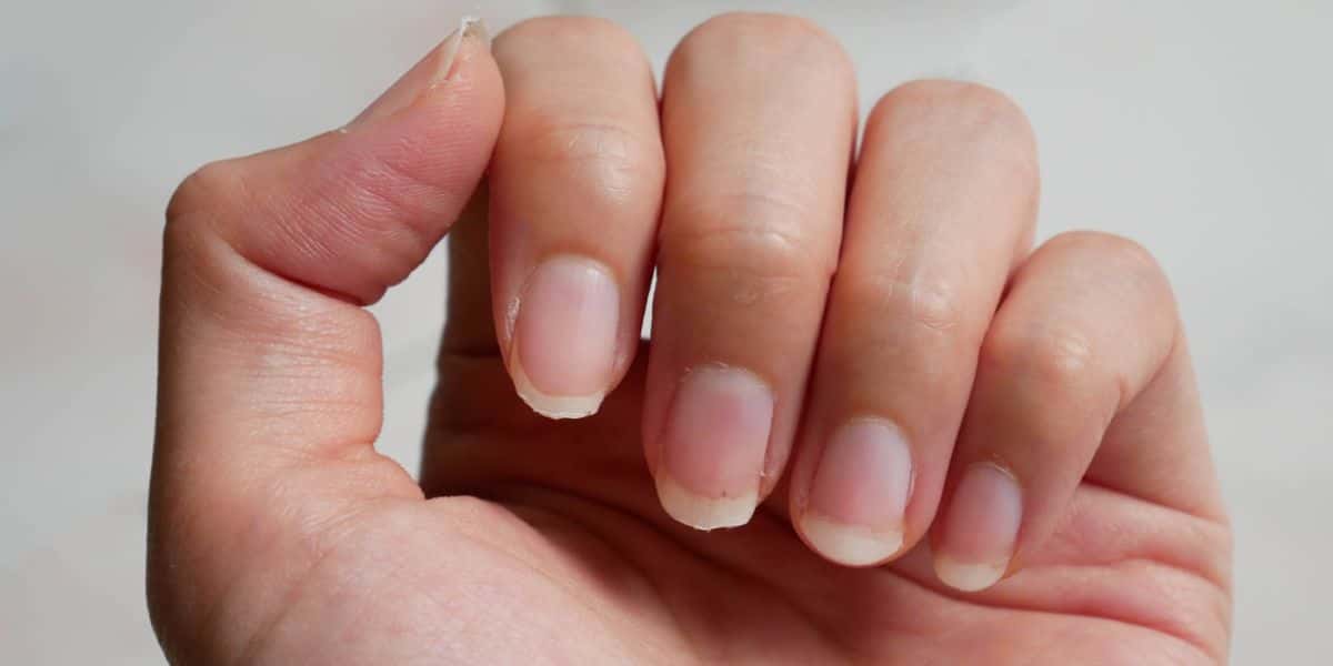 Essas atitudes comuns estão destruindo as suas unhas (Foto: Internet)