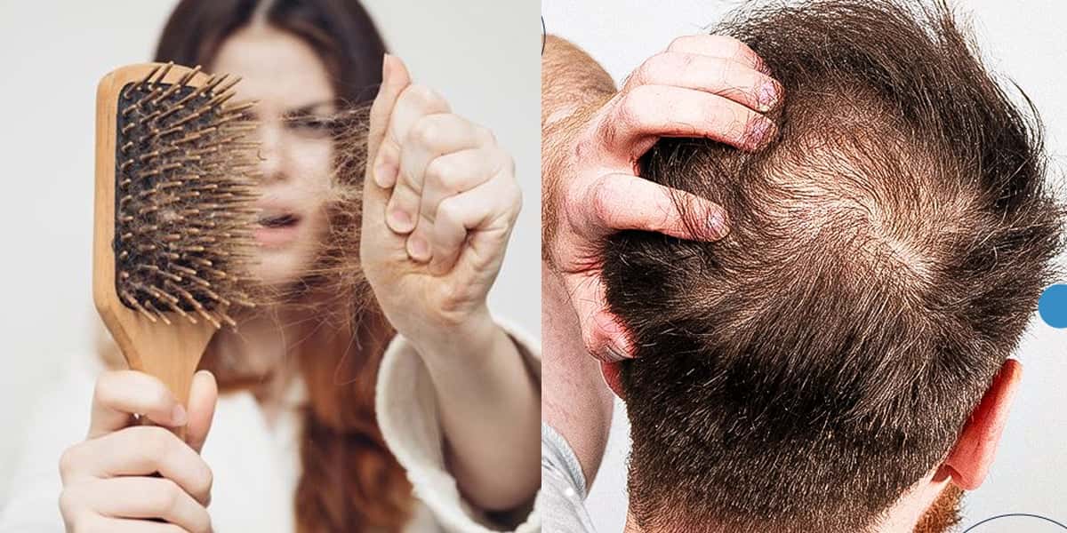 Queda de cabelo e calvície (Foto: Reprodução, Montagem - TV foco)