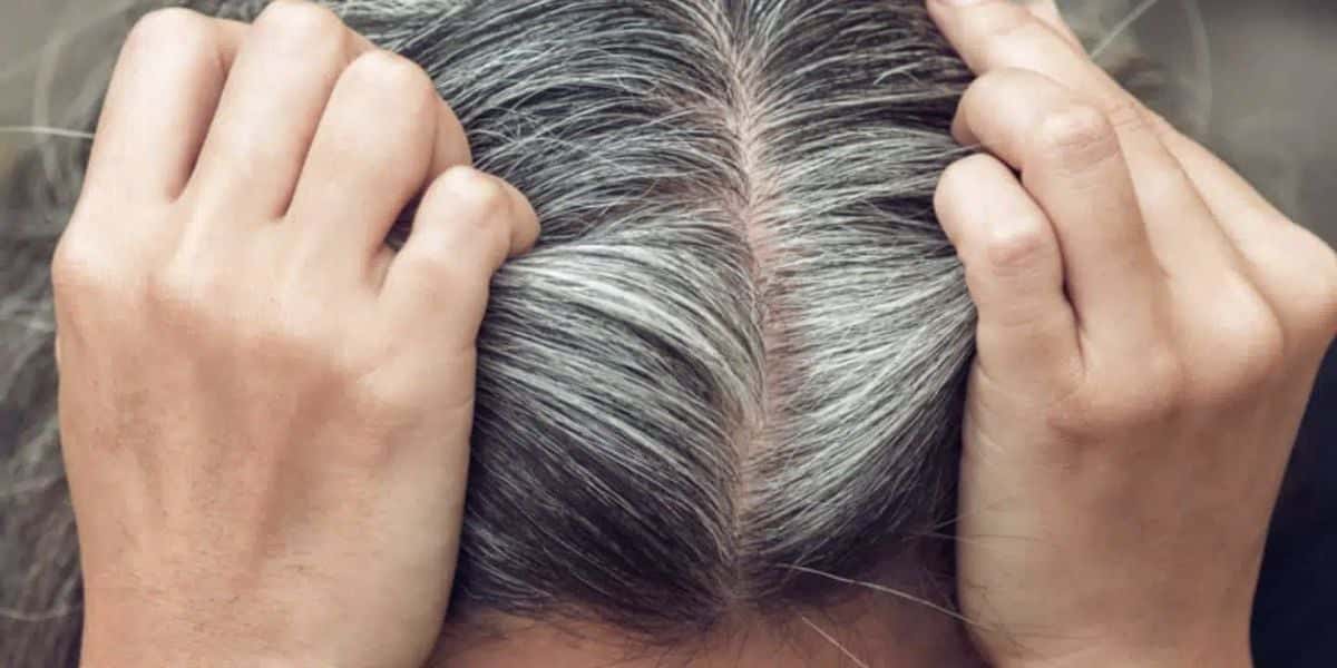 Se livre do cabelo grisalho (Reprodução/Internet)