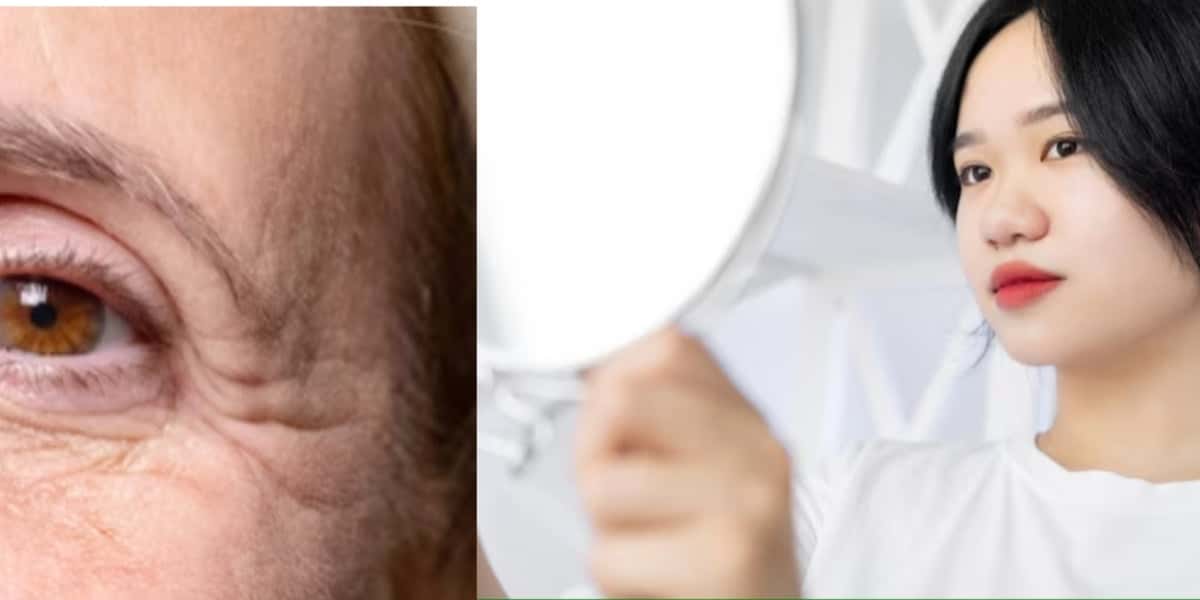 Botox natural e caseiro incrível (Foto: Reprodução/ Internet)