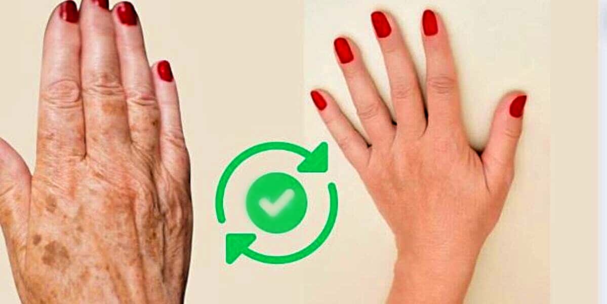 Mãos rejuvenescidas em até 30 anos com essa receita caseira (Foto Reprodução/Montagem/TV Foco)