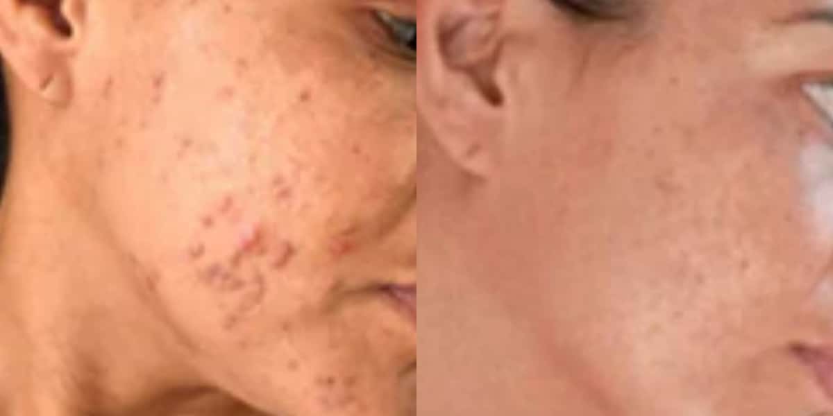Colágeno caseiro (Foto: Divulgação)