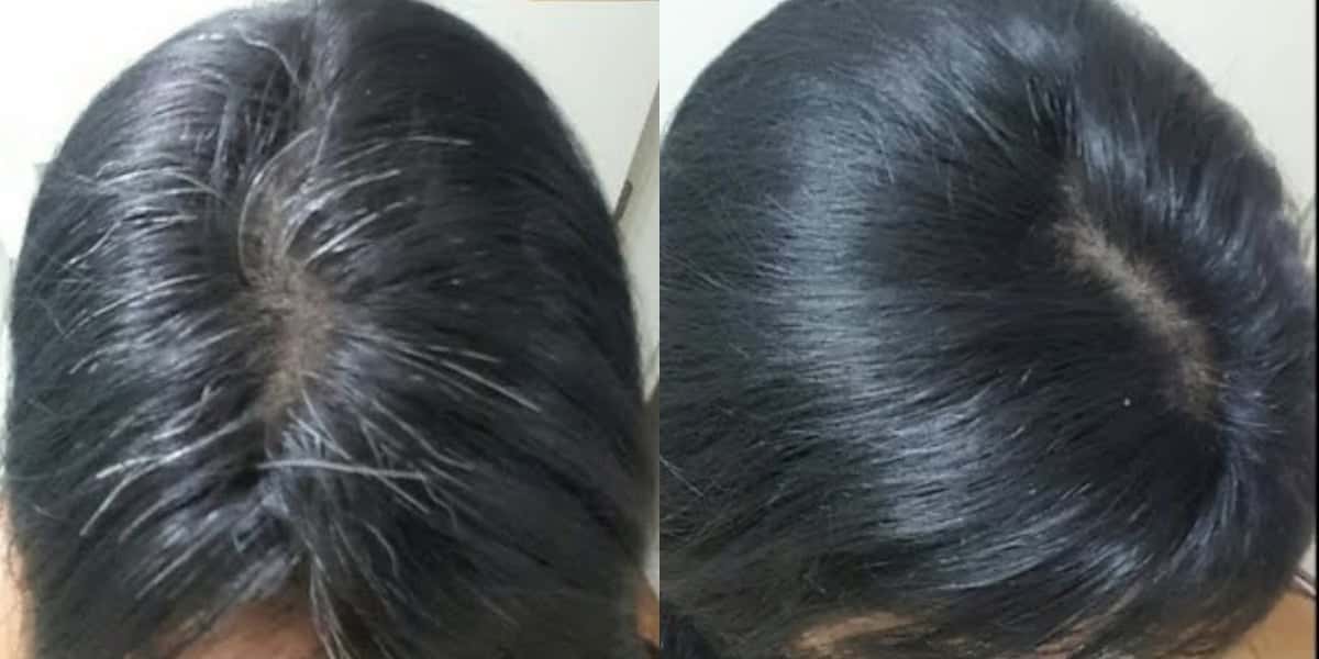Adeus fios brancos com essa mistura que vai deixar o cabelo perfeito (Foto: Divulgação)