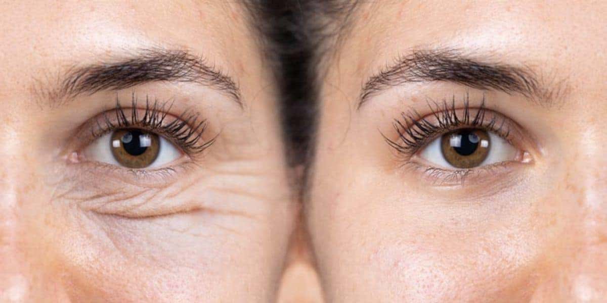 Método de depilação Pinça, cera ou linha? (Foto: Reprodução / Internet)
