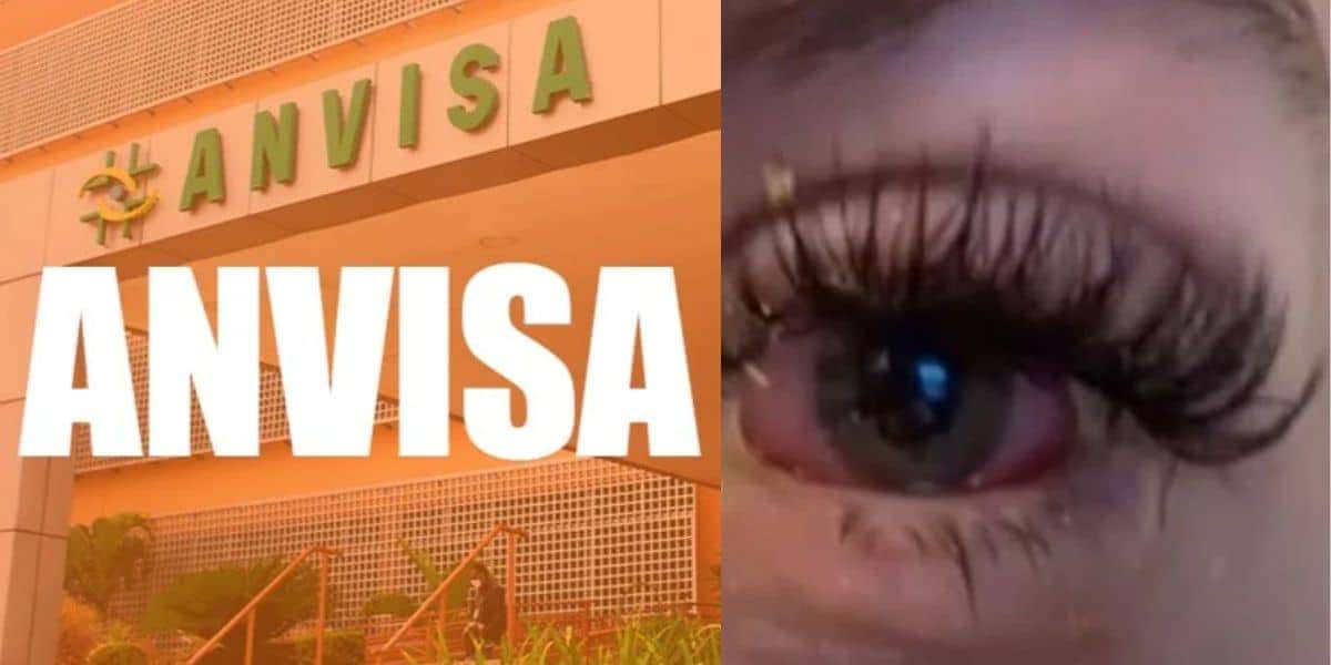 3 marcas que foram proibidas pela Anvisa após reações graves e até cegueira (Foto: Internet)