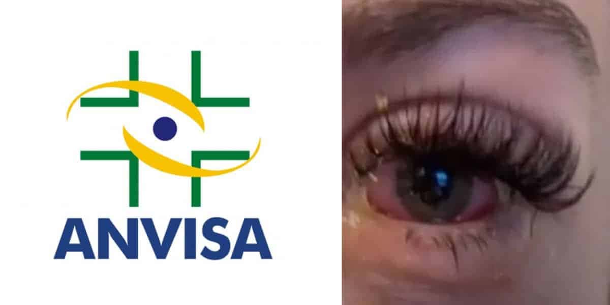 Anvisa faz alerta urgente e proíbe 3 produtos queridinhos entre as mulheres (Foto: Internet)