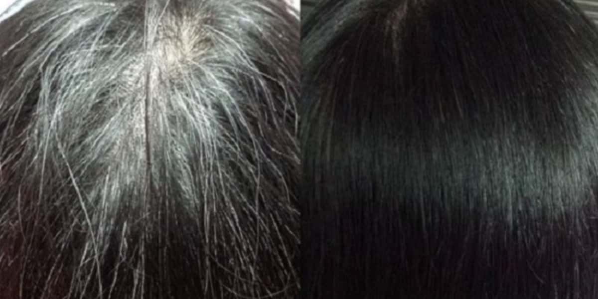 Mulher com cabelo branco e a mudança depois de usar a mistura especial (Foto: Reprodução/ Internet)