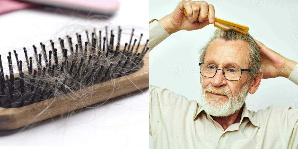 5 remédios para evitar a queda de cabelo (Reprodução: Montagem TV Foco)